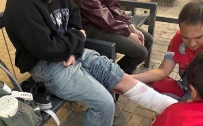 В Алматы снова произошел наезд электросамоката на ребенка