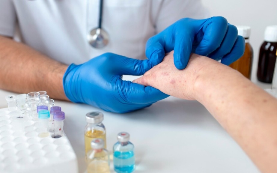 Свыше 900 заболевших ветряной оспой выявили в Кызылординской области за год