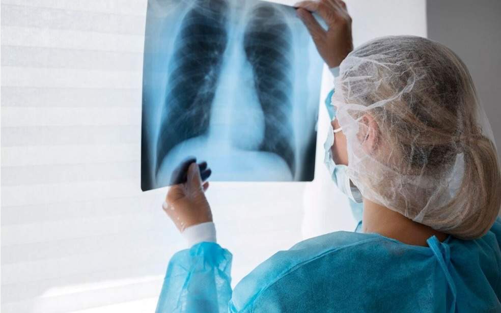 Заболеваемость туберкулезом снизилась в Алматы