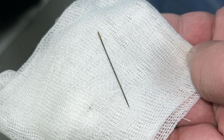 Иглу из брюшной полости младенца извлекли врачи в Туркестане