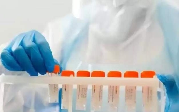 Несколько стран усилили санитарный контроль на границах из-за вируса Нипах