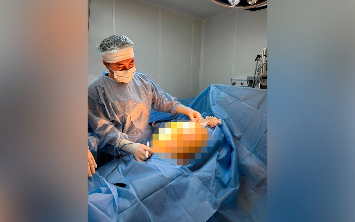 Лечила БАДами 25-килограммовую опухоль: алматинские онкологи провели уникальную операцию